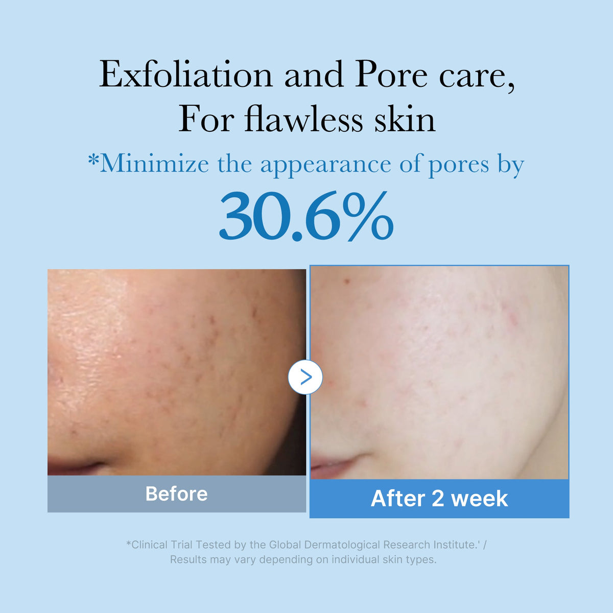 Zero Pore Toner F1