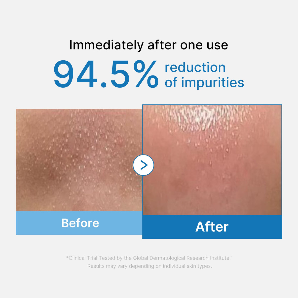 Zero Pore Blackhead Deep Cleansing Oil V0