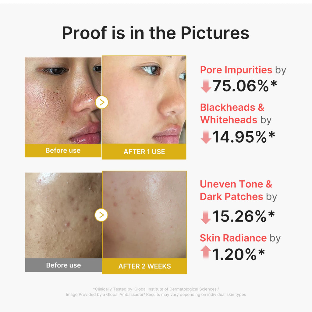 Kojic Acid Turmeric Peel Shot Y1