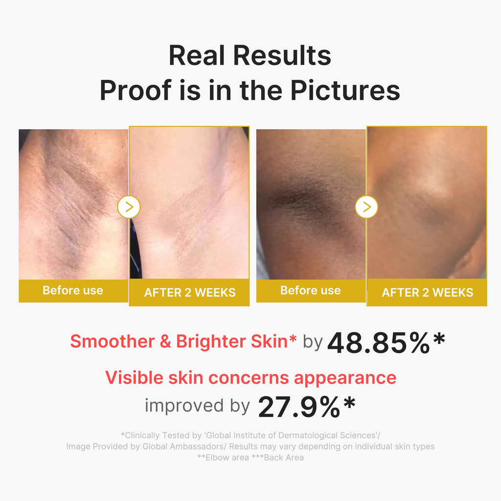 Kojic Acid Turmeric Body Peel Shot L2