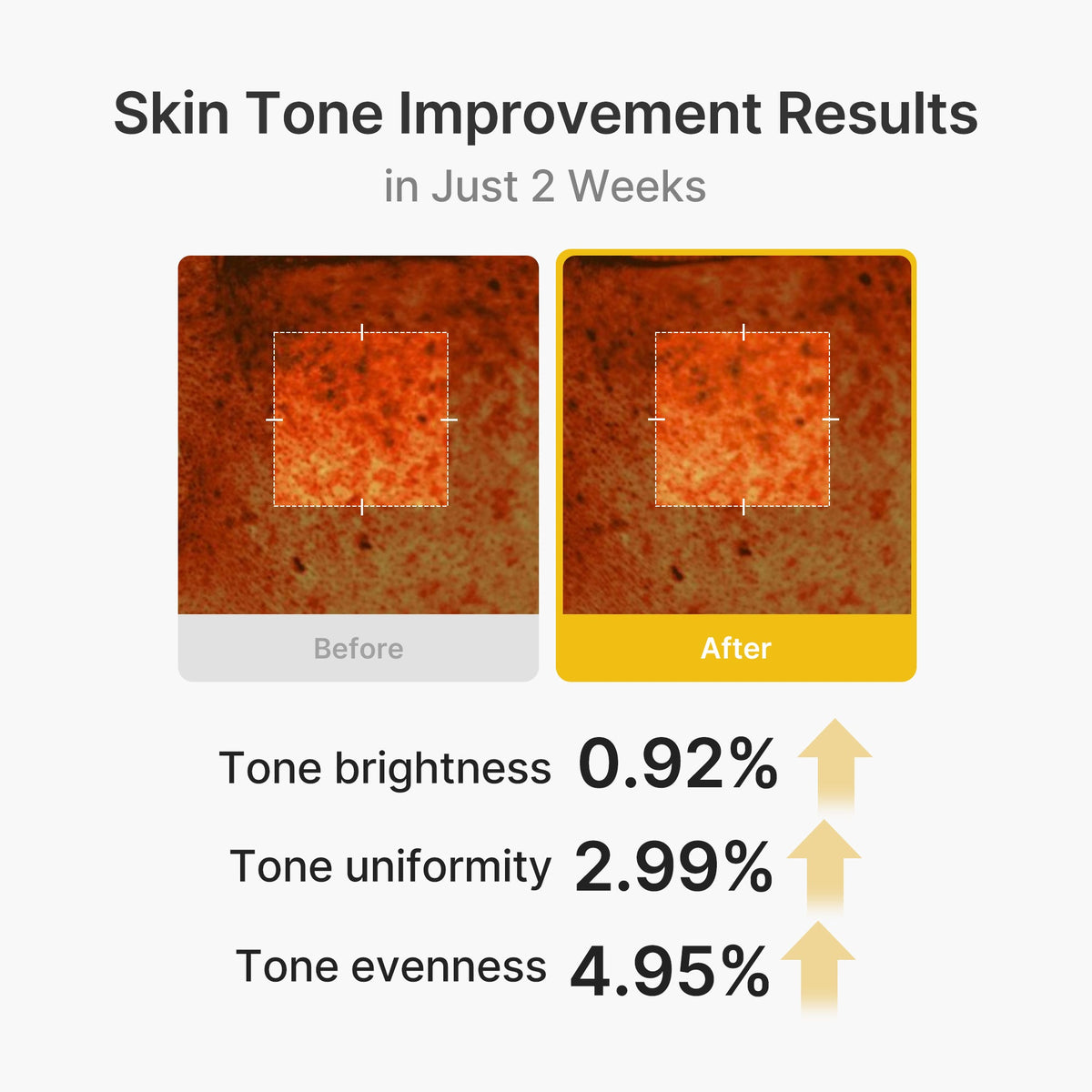 Kojic Acid Turmeric Vita Capsule Cream E7
