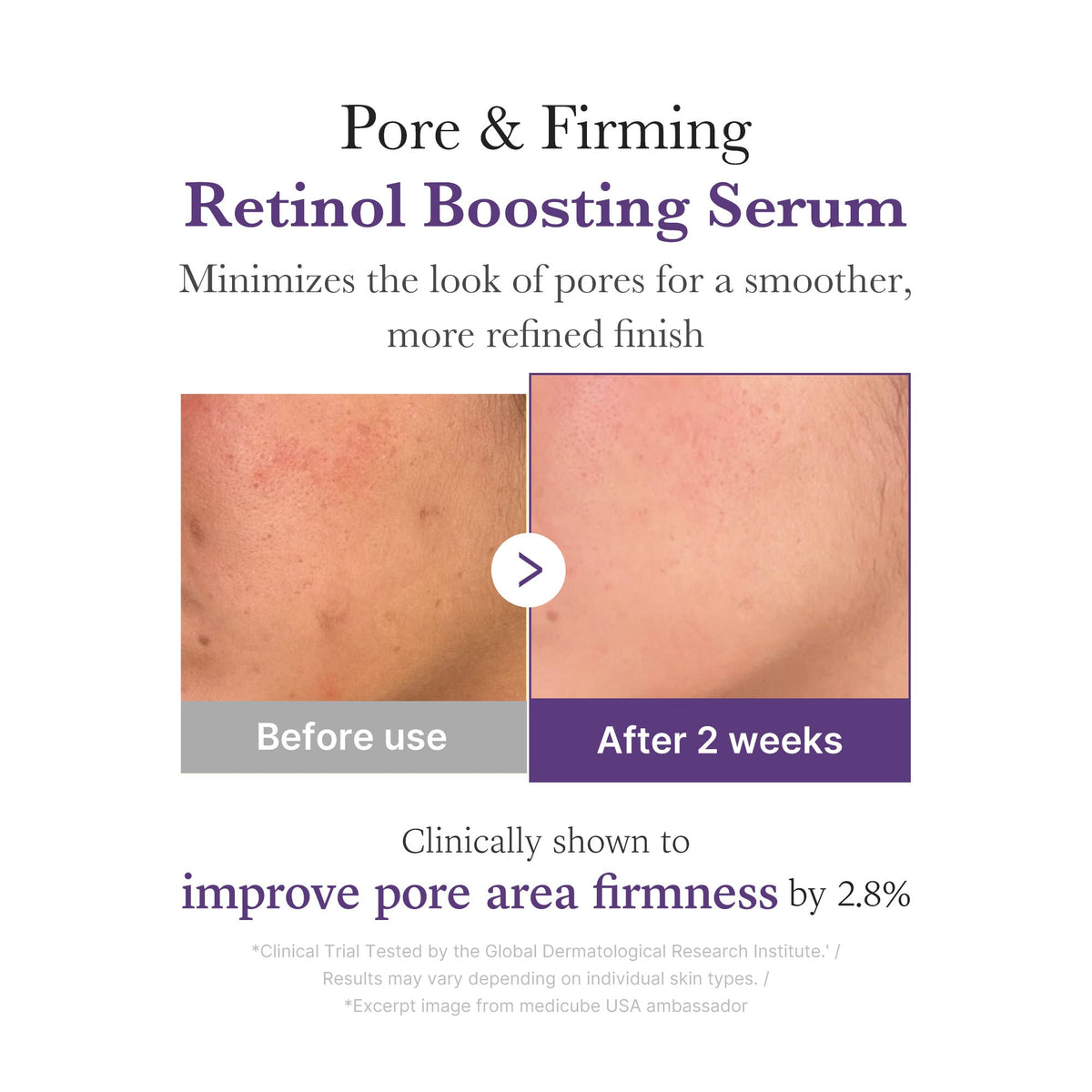 Retinol NMN Boosting Serum G5