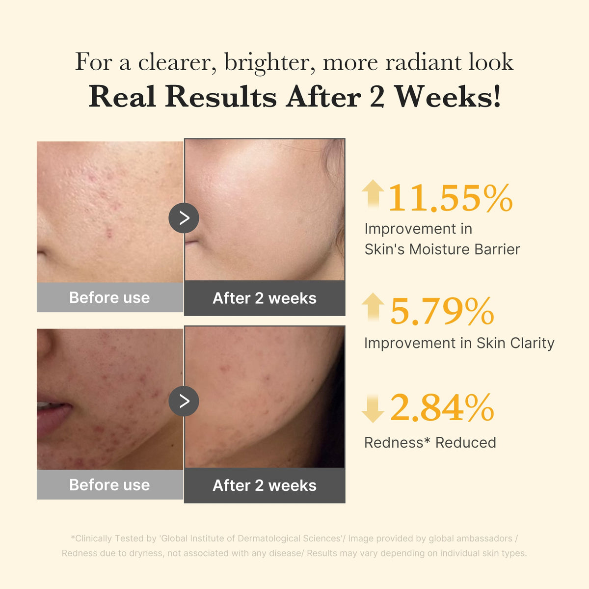 Kojic Acid Turmeric Capsule Serum W8