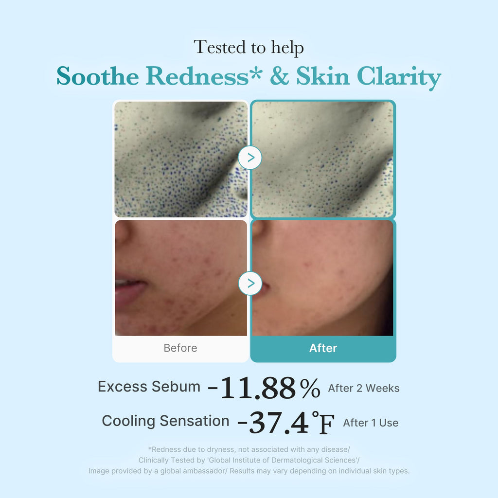 Azelaic Acid Niacinamide Clarifying Toner I4