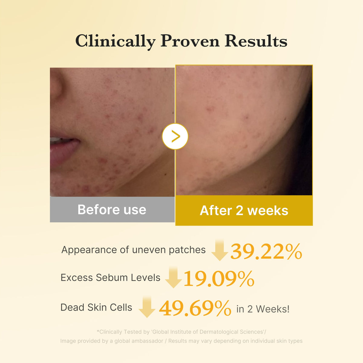 Kojic Acid Tumeric Toner Pad R3