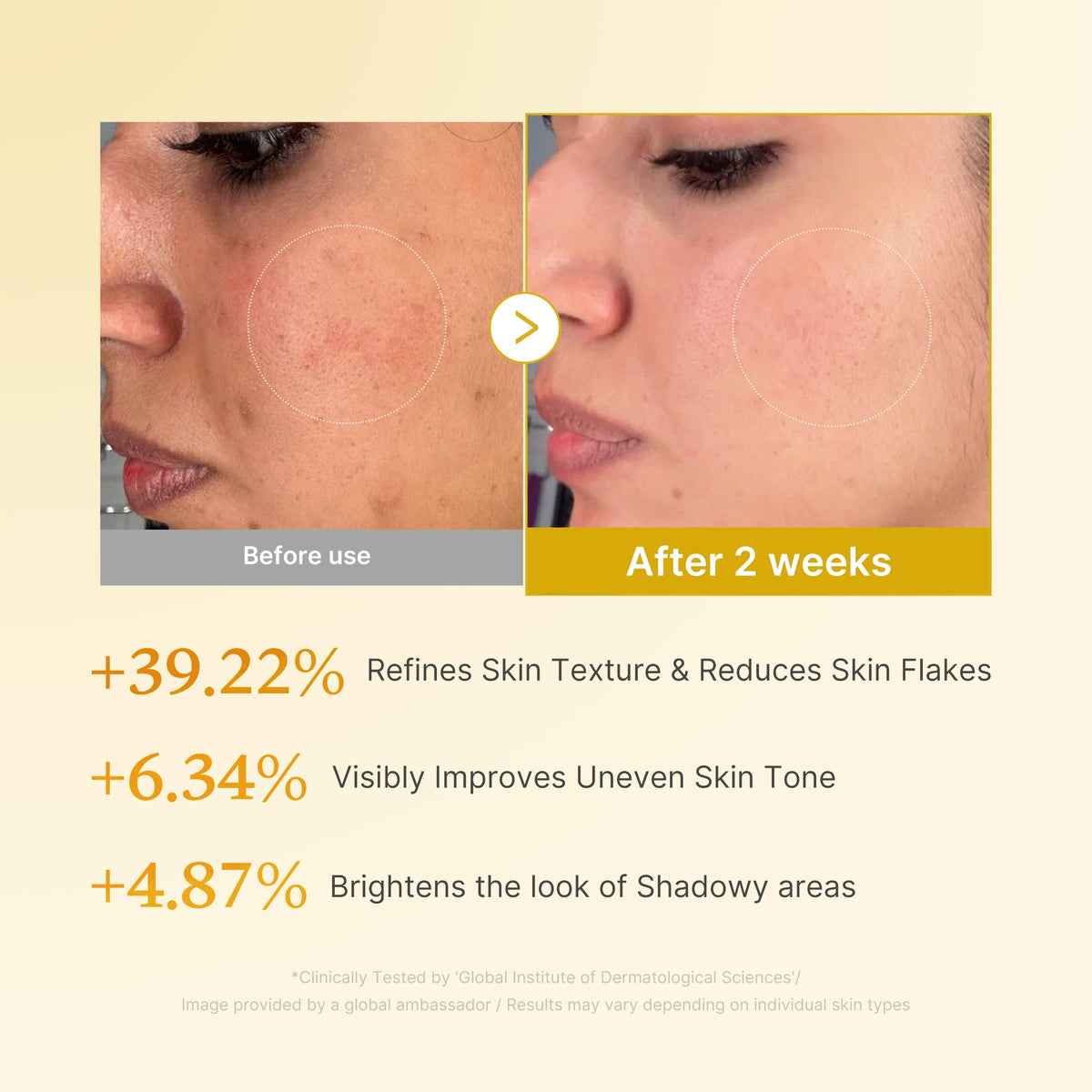 Kojic Acid Turmeric Toner U8