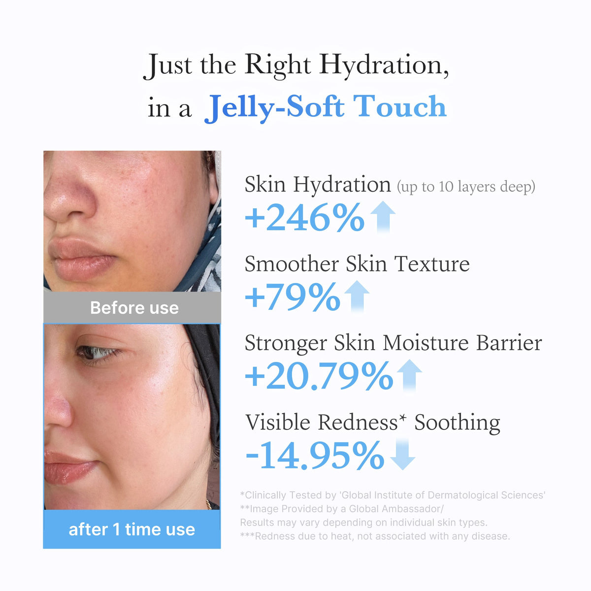 Hyaluronic Ceramide Moisturizing Jelly Cream A9