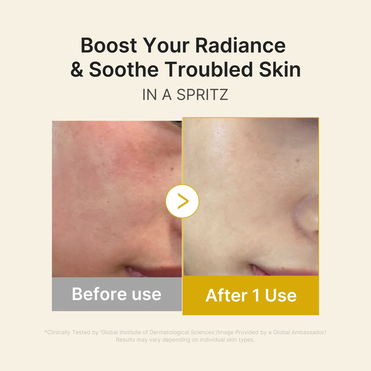Kojic Acid Turmeric Vitamin Gold Jelly Mist Serum A9
