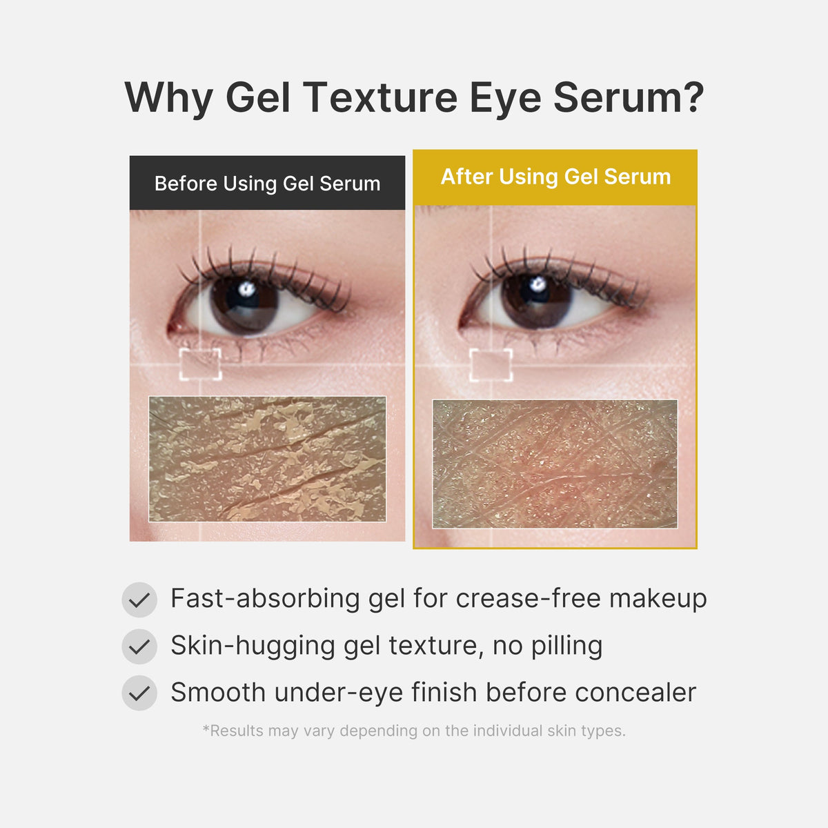 Kojic Acid Tumeric Eye Gel Serum R6
