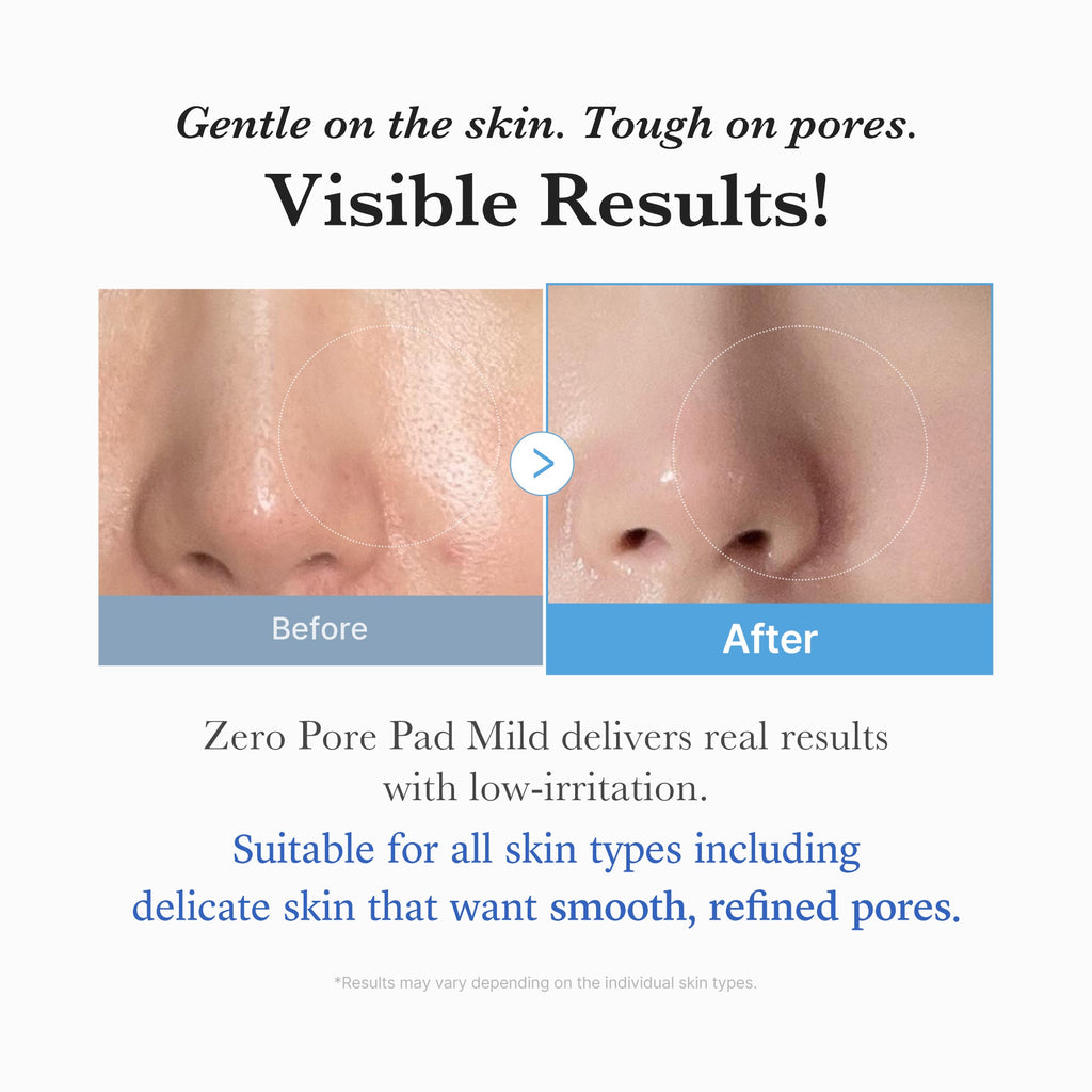 Zero Pore Madecassoside Pads (Mild) X5