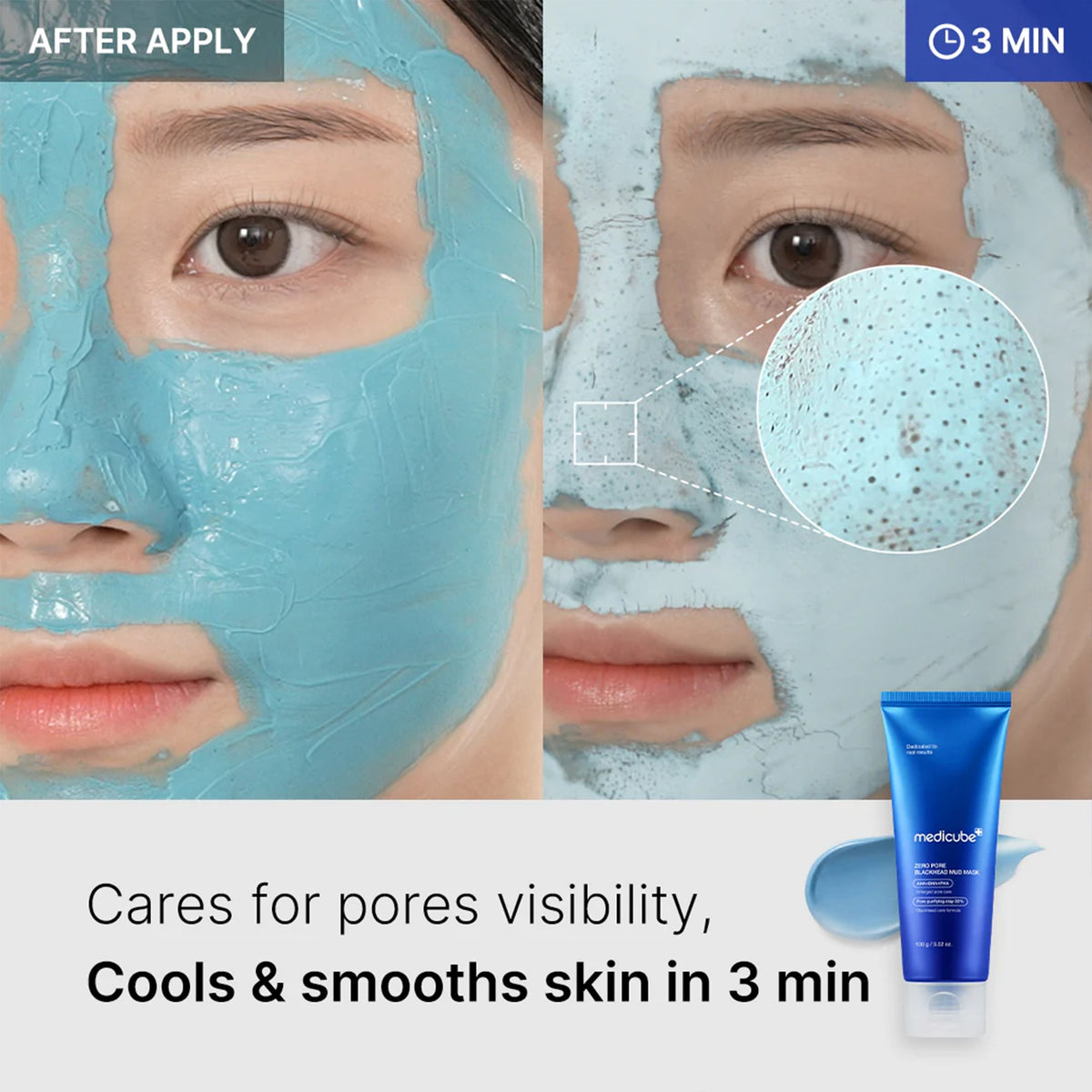 Zero Pore Blackhead Mud Mask U7
