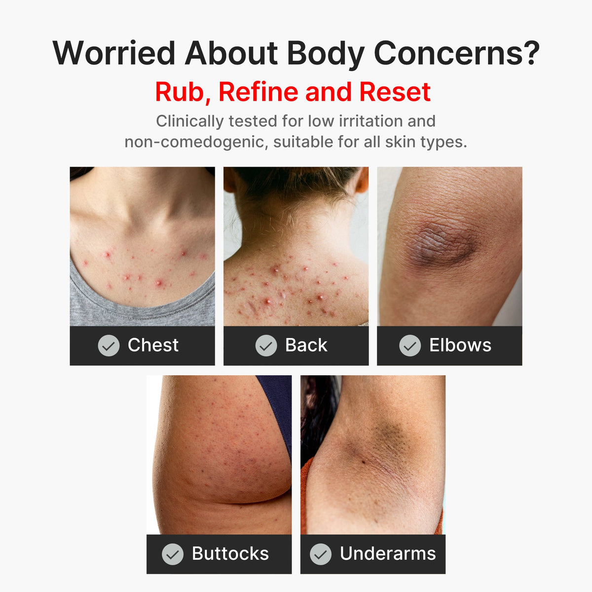 Kojic Acid Turmeric Body Peel Shot L2