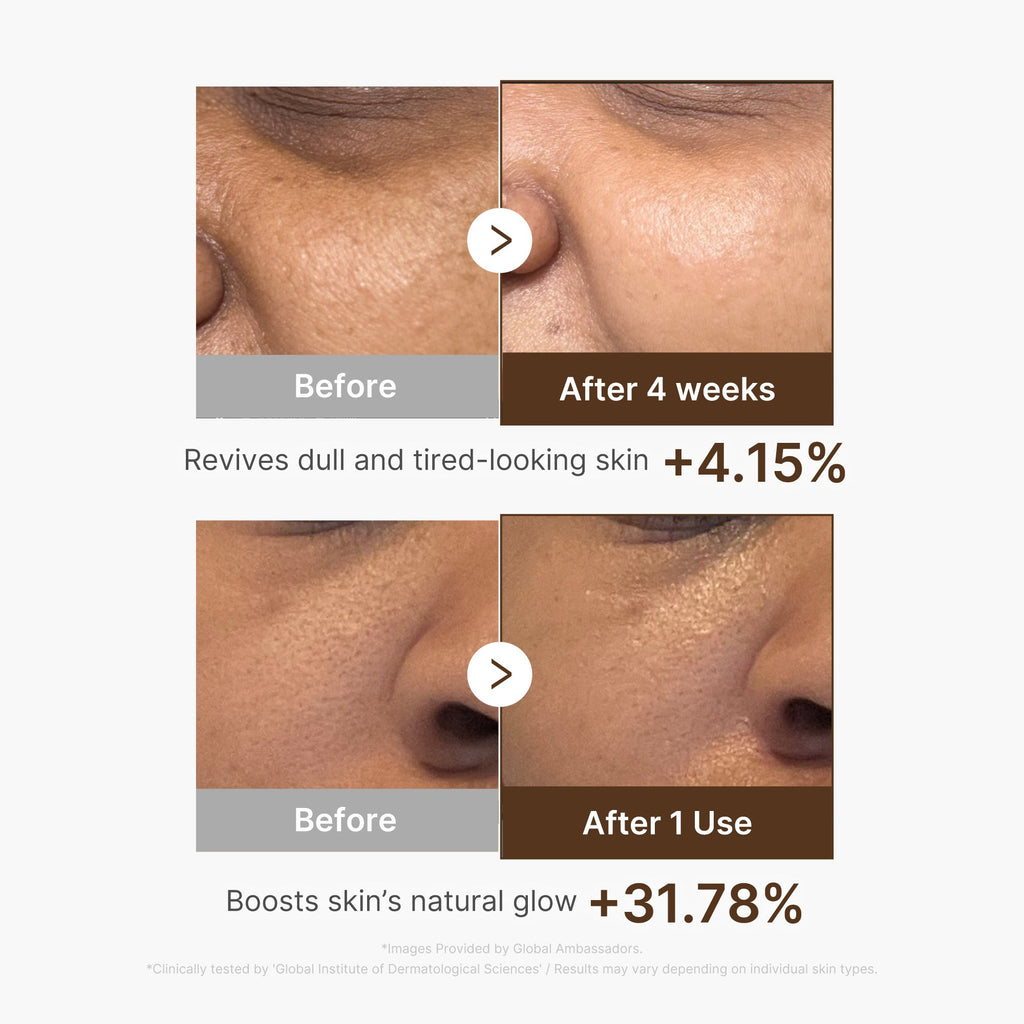 Deep Vitamin C Capsule Serum C1