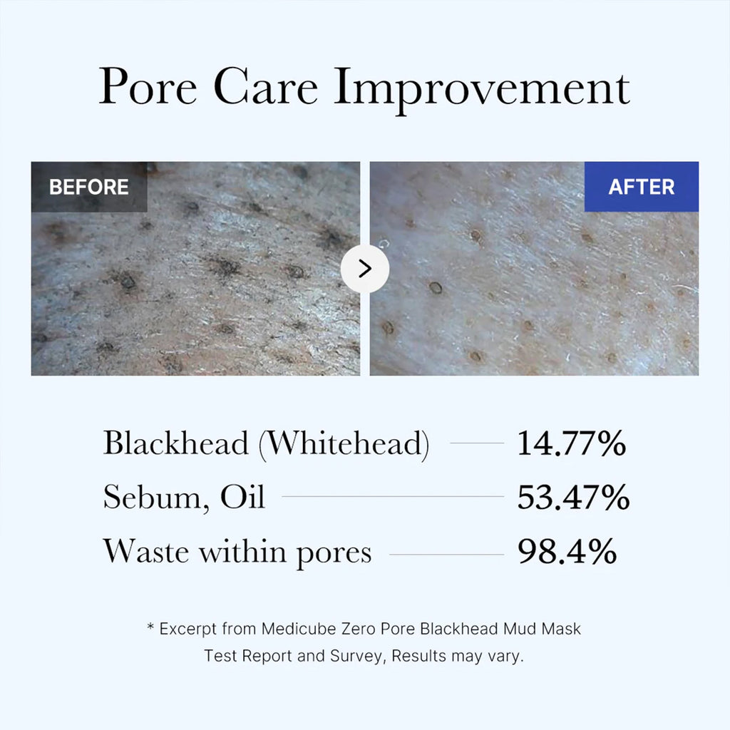 Zero Pore Blackhead Mud Mask U7
