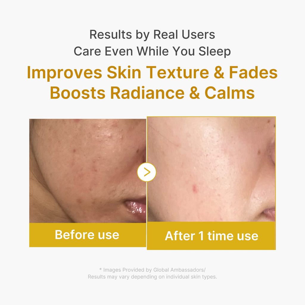 Kojic Acid Turmeric Overnight Wrapping Mask N2