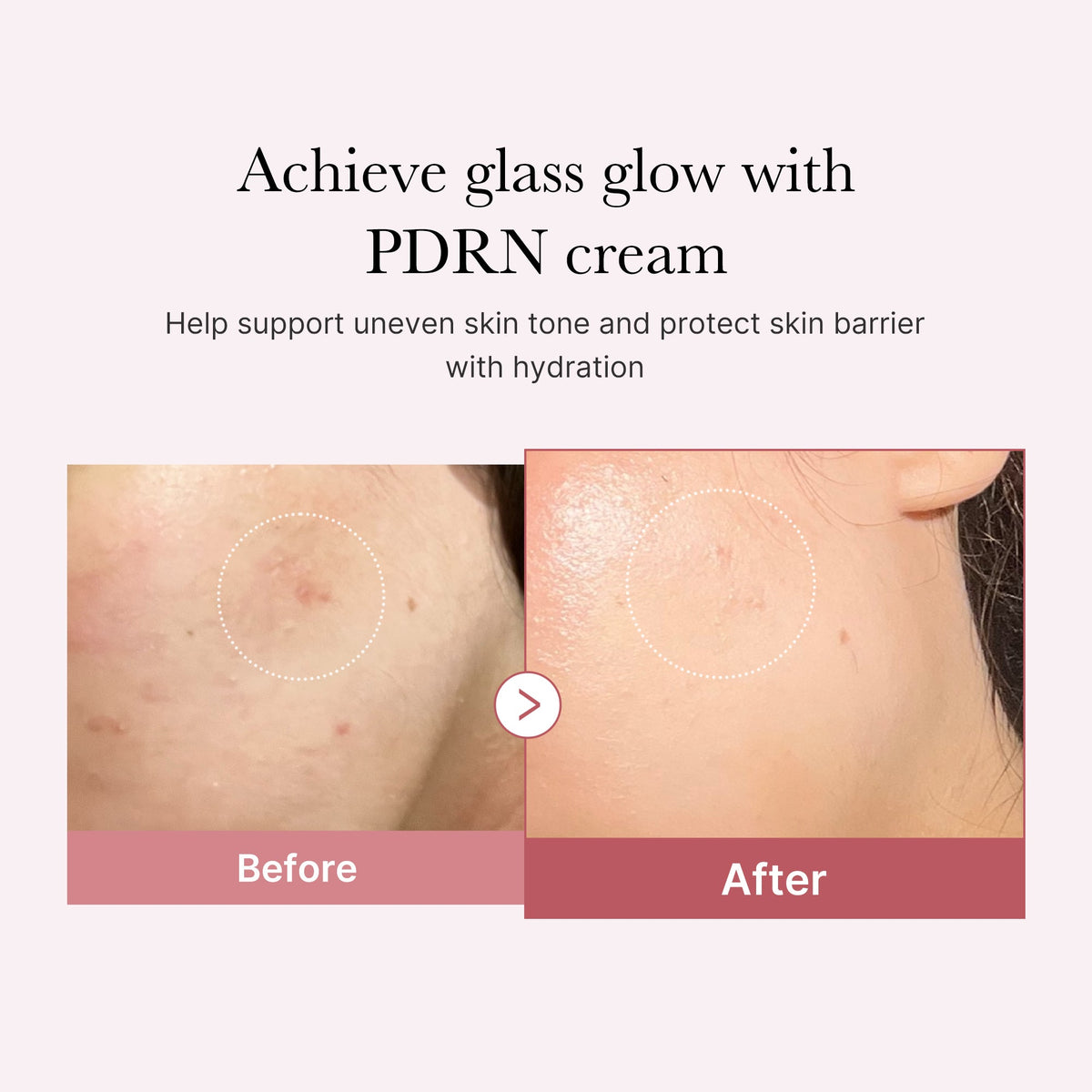 PDRN Pink Peptide Cream W3