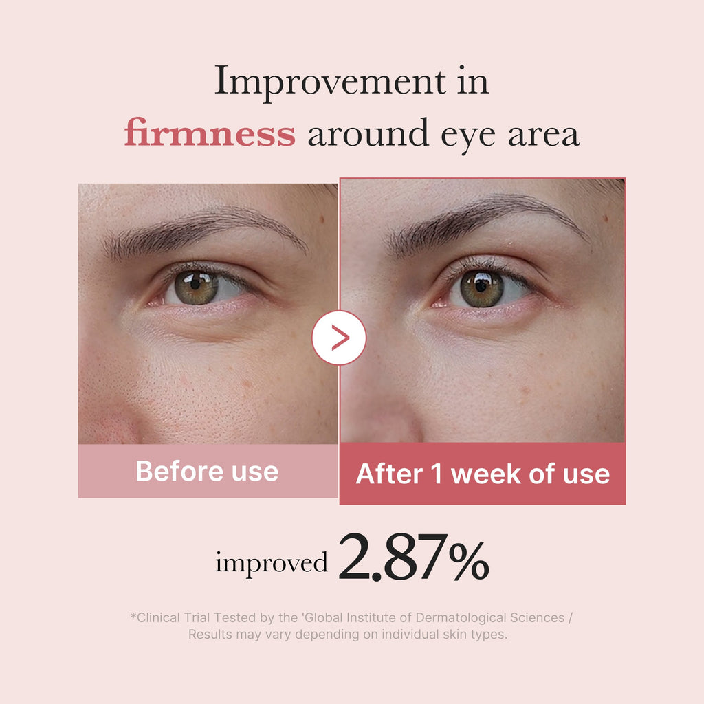 PDRN Pink Peptide Eye Cream L0