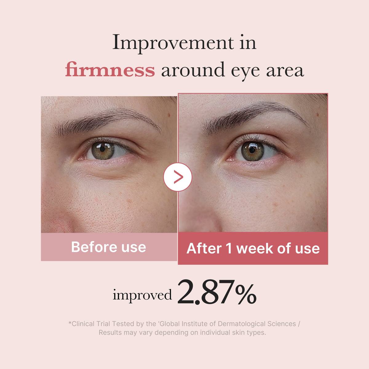 PDRN Pink Peptide Eye Cream L0