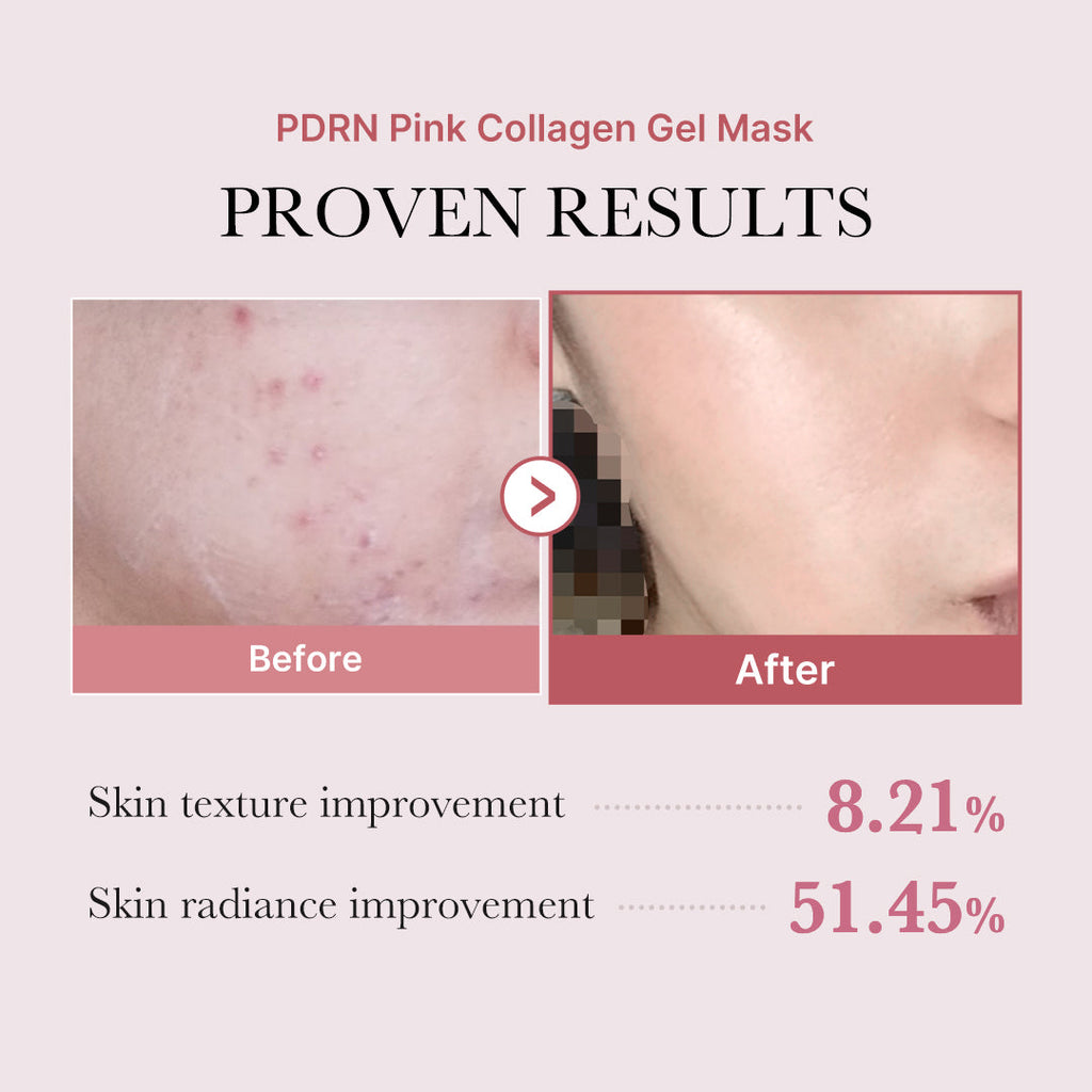 PDRN Pink Glow Full Set I2