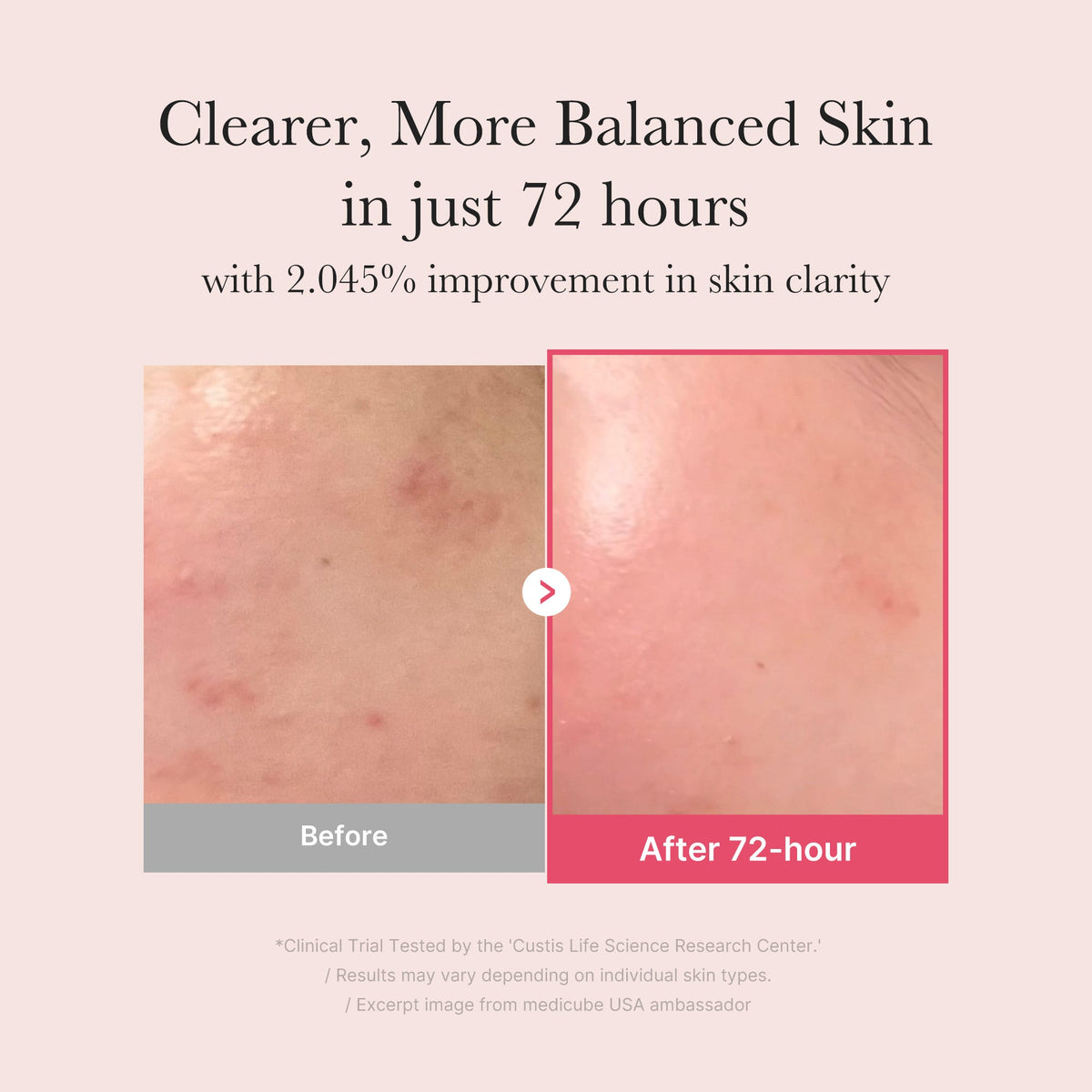 TXA Niacinamide Serum A8